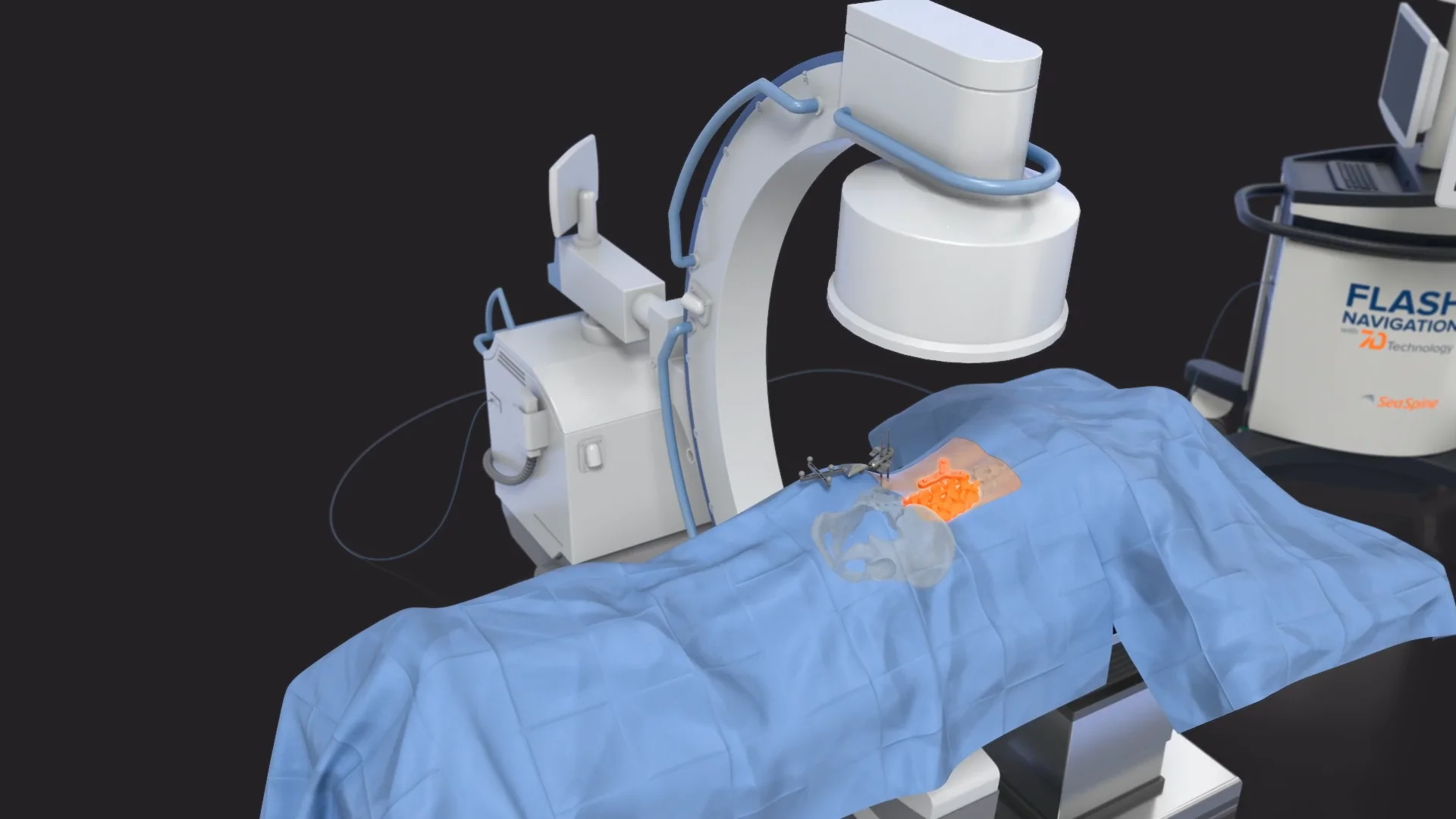 7D Percutaneous Module