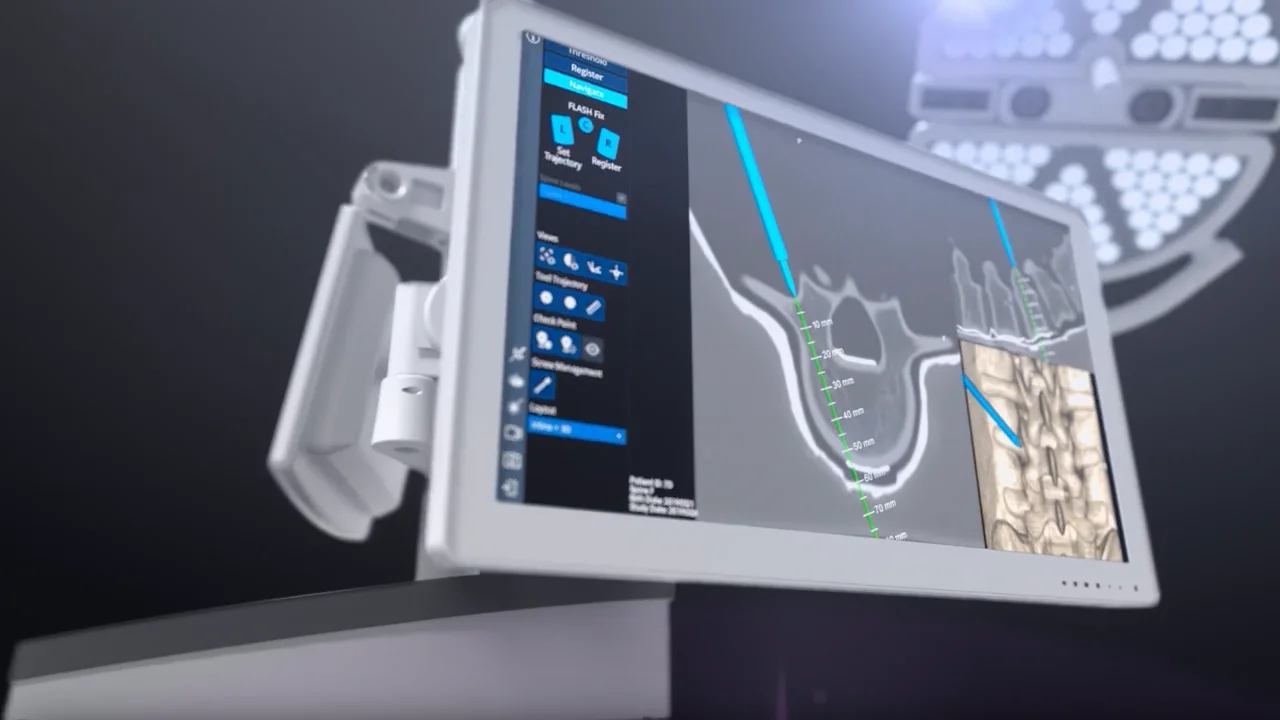 7D FLASH Navigation | Spine Module - Orthofix