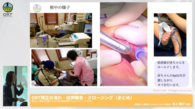 ORT矯正の流れ #5