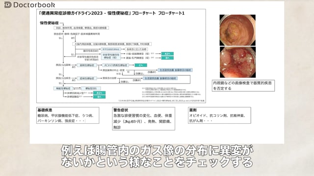 医師出演】胃食道逆流症 part3～胃食道逆流症の内視鏡的治療