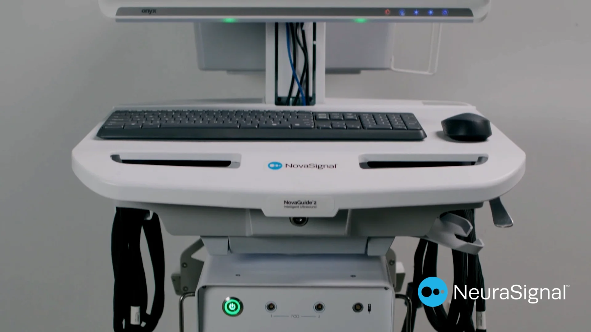 What Is a Transcranial Doppler Ultrasound (TCD)?