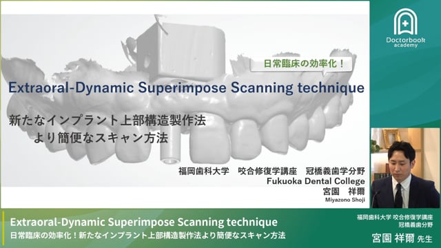  効率と精度を両立する新しいインプラント上部構造制作法：Extraoral-Dynamic Superimpose Scanning technique（EDSS）