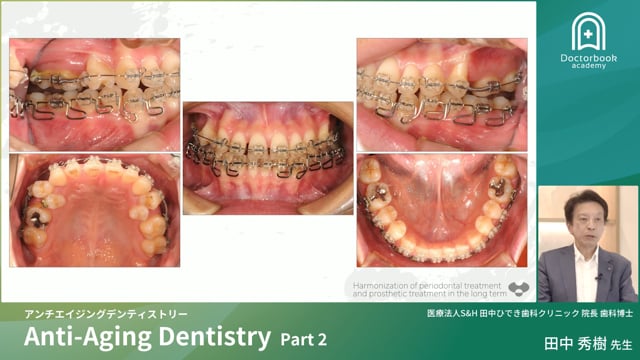 矯正治療、補綴治療、歯列矯正によるアンチエイジングデンティストリー 