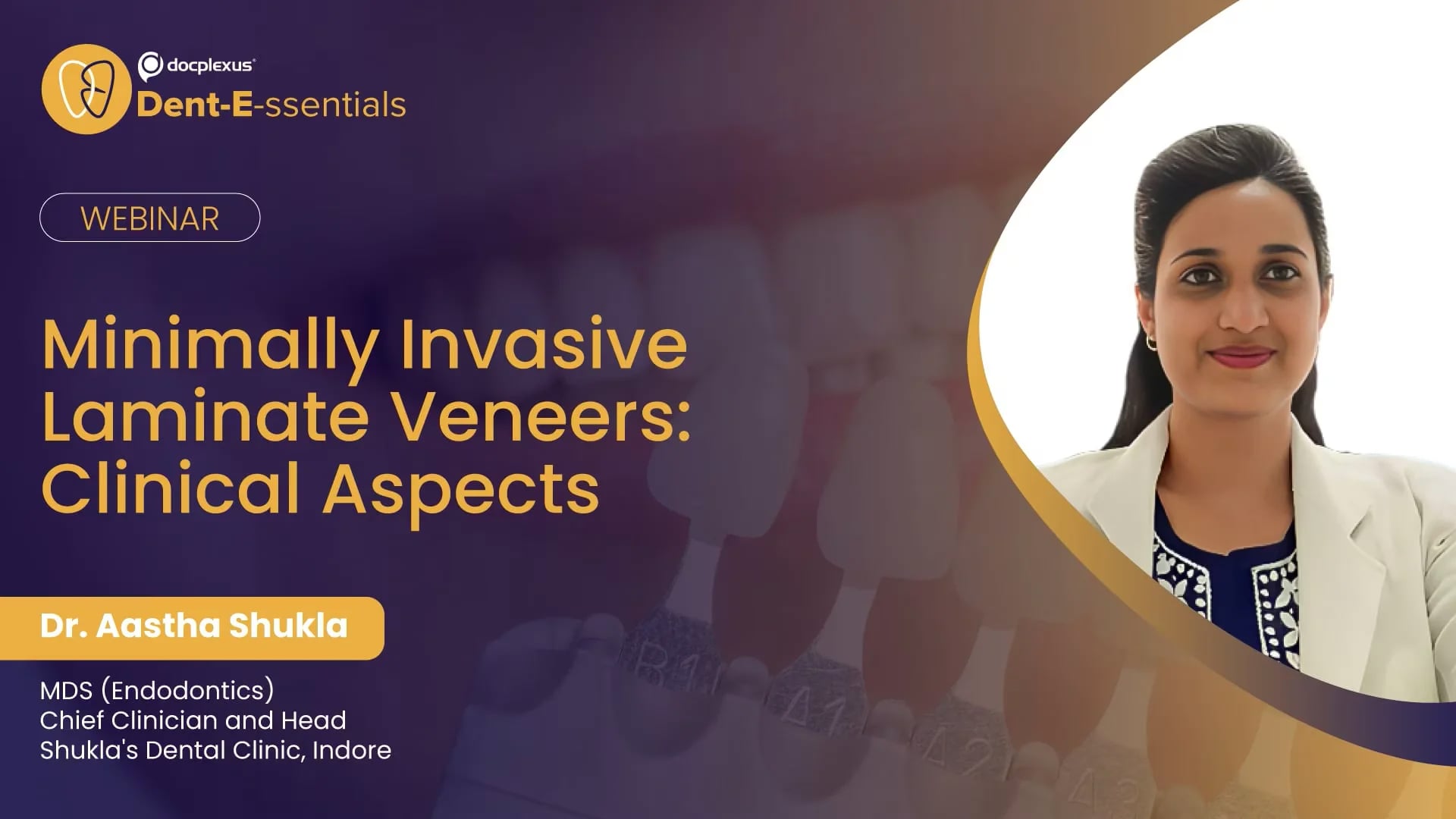 Minimally Invasive Laminate Veneers: Clinical Aspects