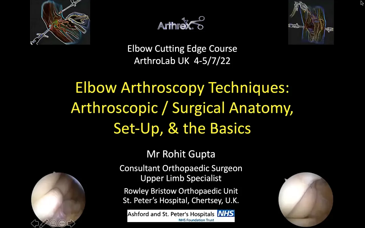 Elbow Arthroscopy Set-up & Basics_RRG recording