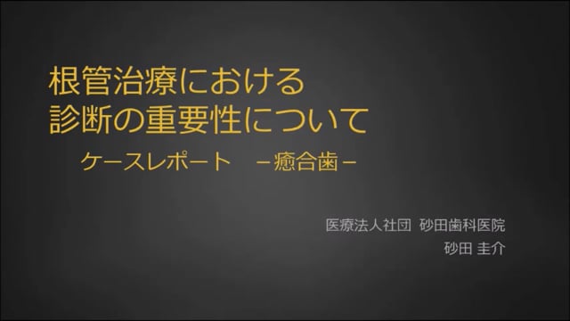 根管治療における診断の重要性について＿ケースレポート-癒合歯-｜砂田圭介先生(Topics)