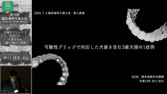 可撤性ブリッジで対応した犬歯を含む3歯欠損の１症例 井口佳大先生