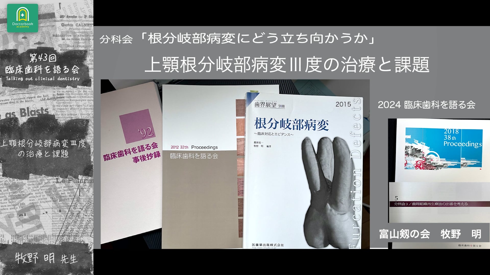 上顎根分岐部病変 III度の治療と課題 牧野明先生