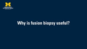 Fusion Biopsy on Vimeo