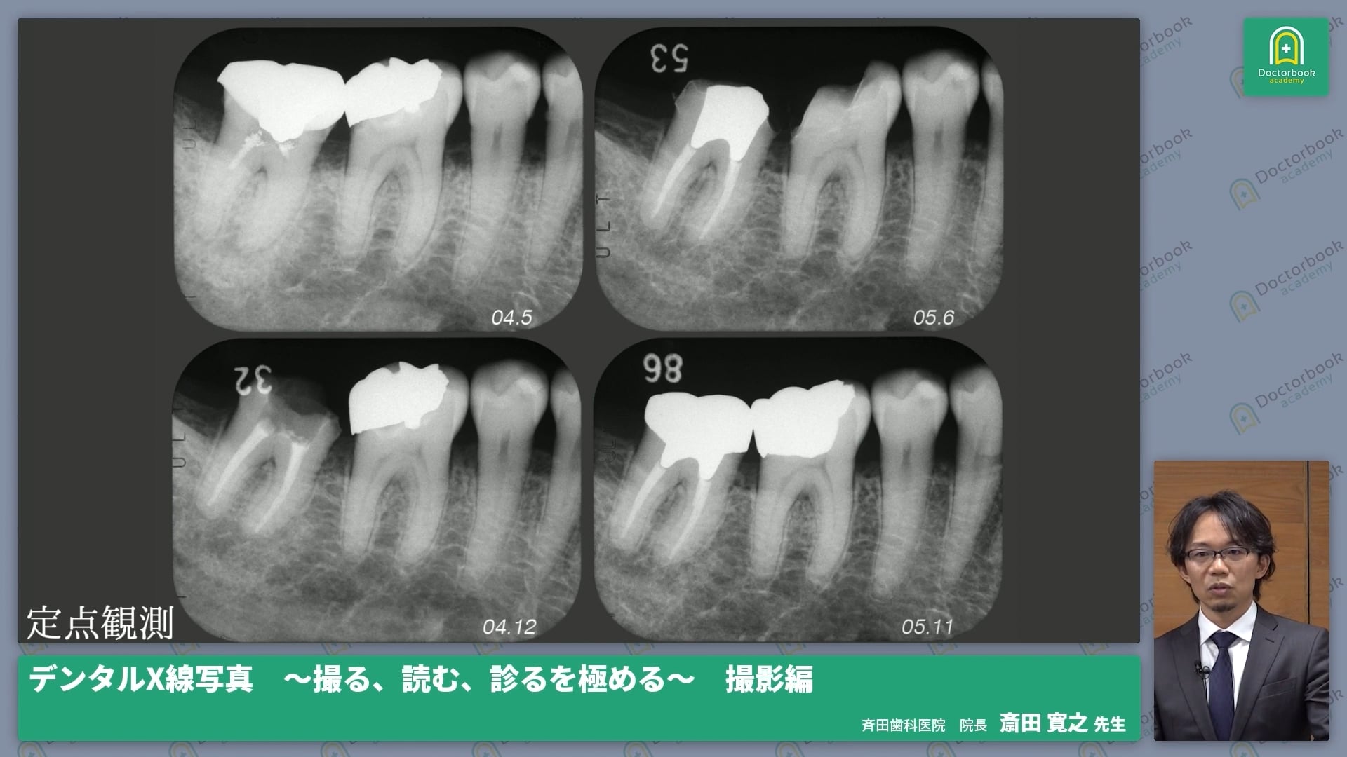  臨床知見録_レントゲン_定点観測