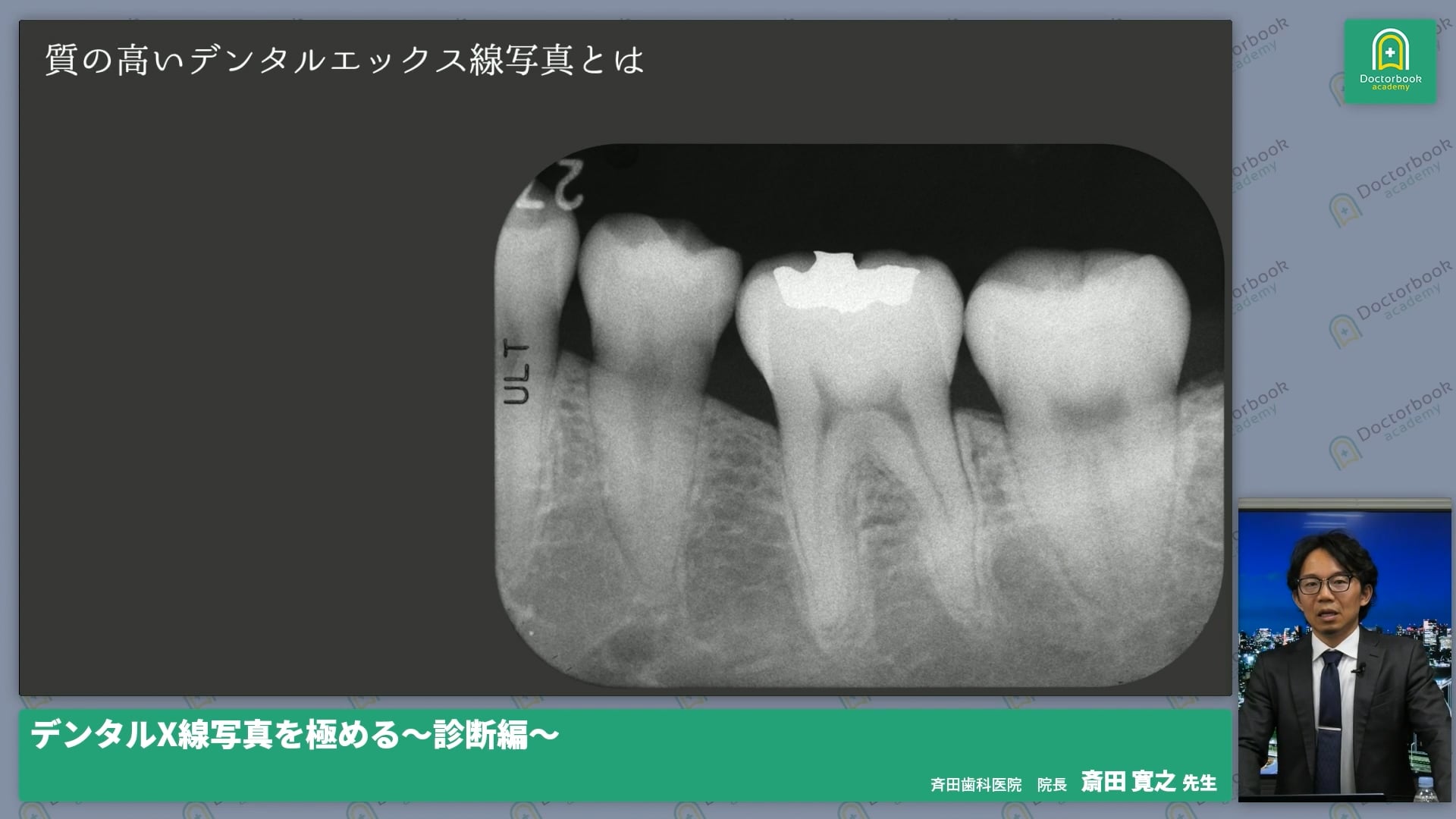  臨床知見録_レントゲン_質の高いデンタルとは