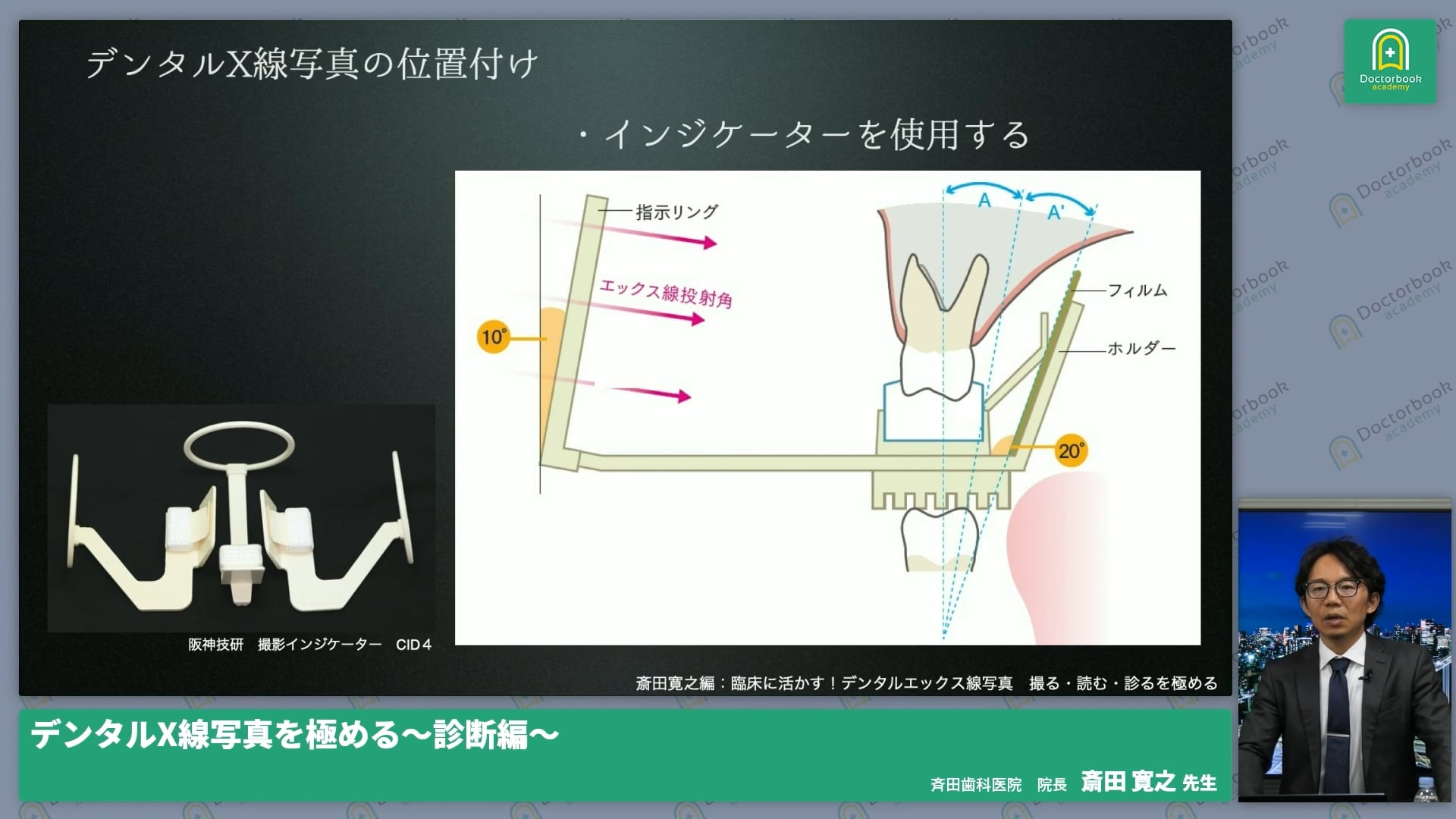  臨床知見録_レントゲン_インジケーターの種類