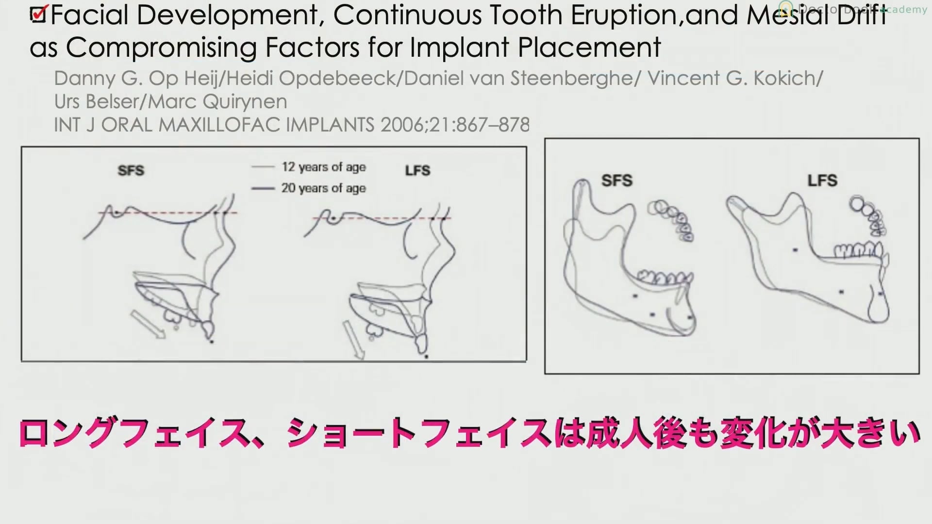  臨床知見録_レントゲン_facialタイプ