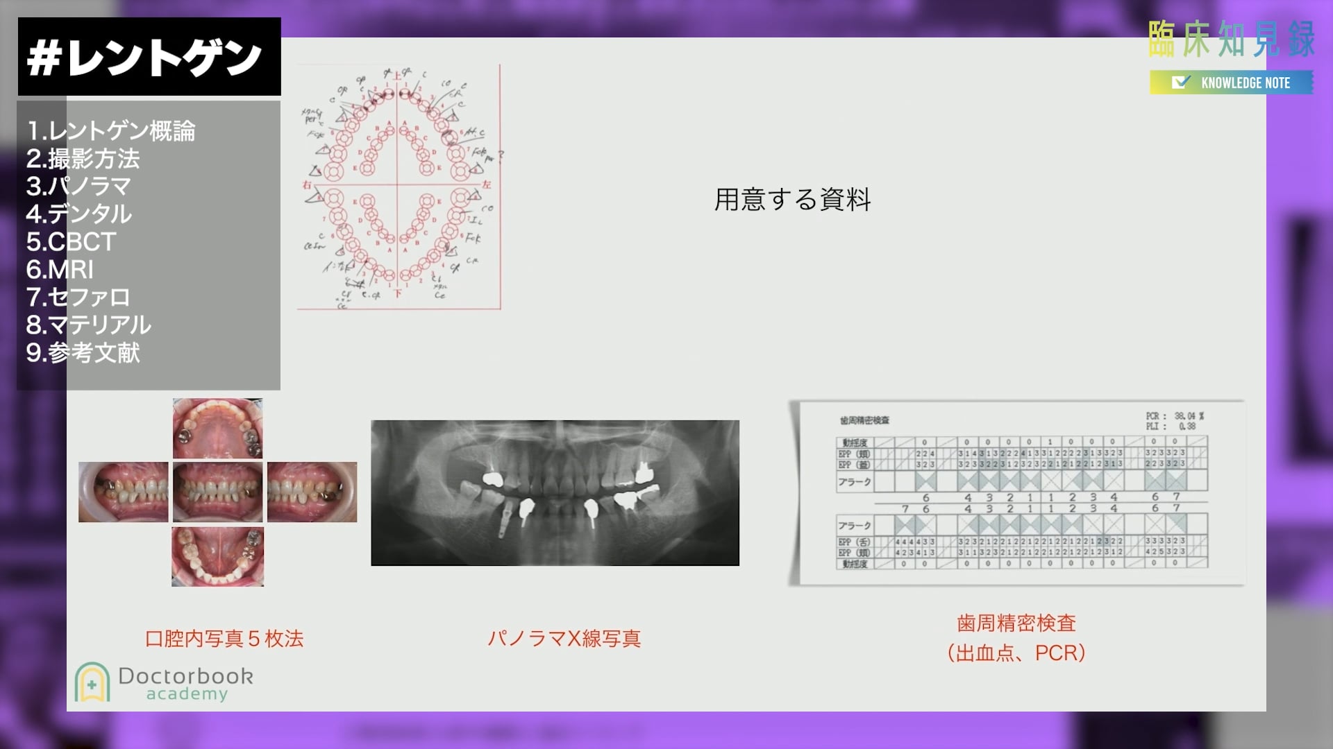  臨床知見録_レントゲン_CM