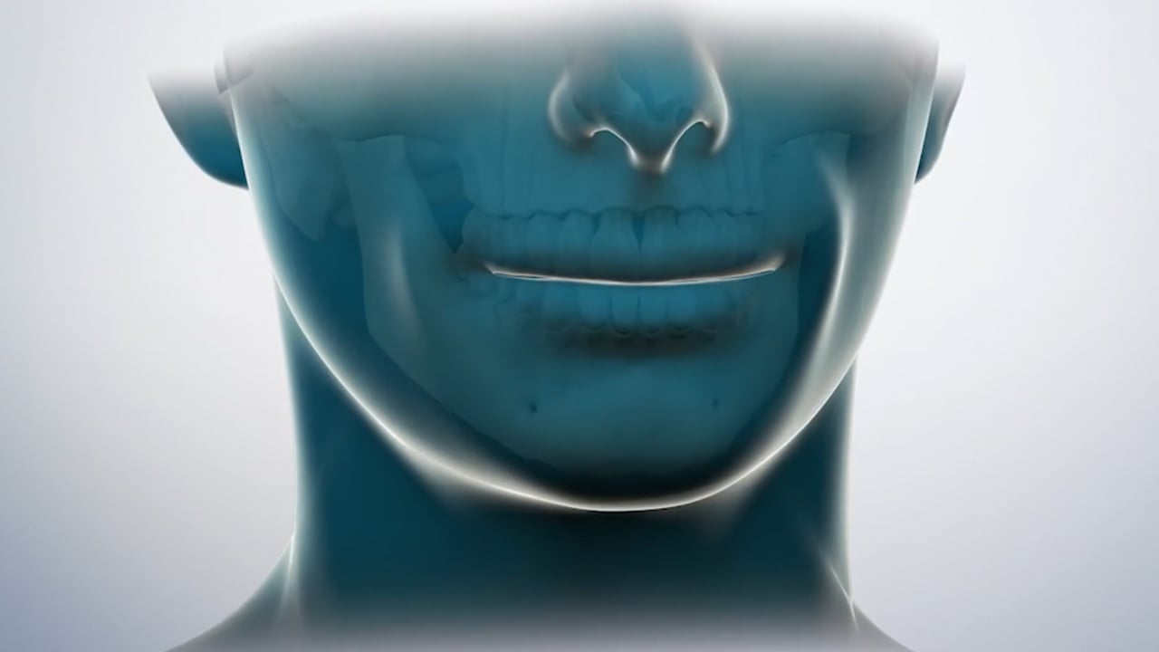 Play patient video