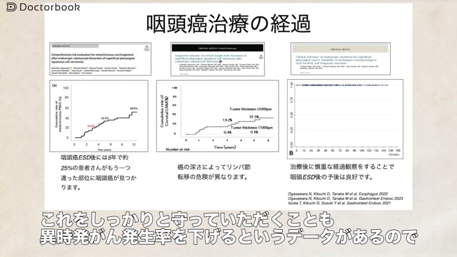 表在咽頭がんpart3～表在咽頭がんの内視鏡治療後のフォローアップ～