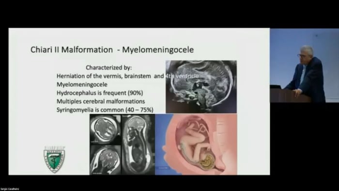 Fetal Neurosurgery for Occipital Encephaloceles