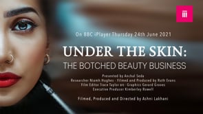Related Embedded Video Item Thumbnail