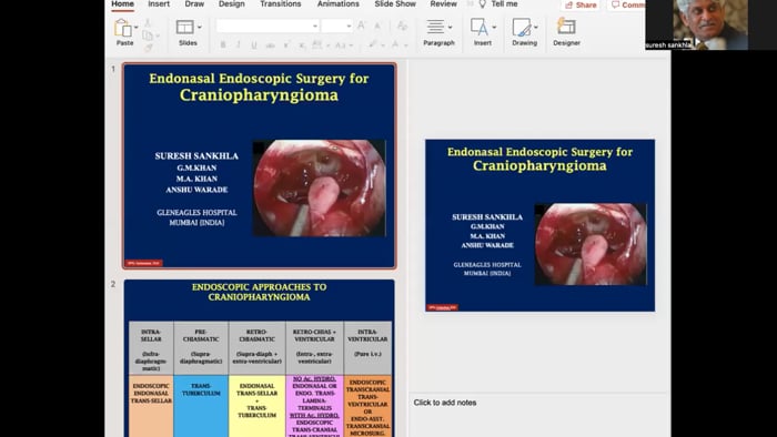 Endonasal Endoscopic Surgery for Craniopharyngioma