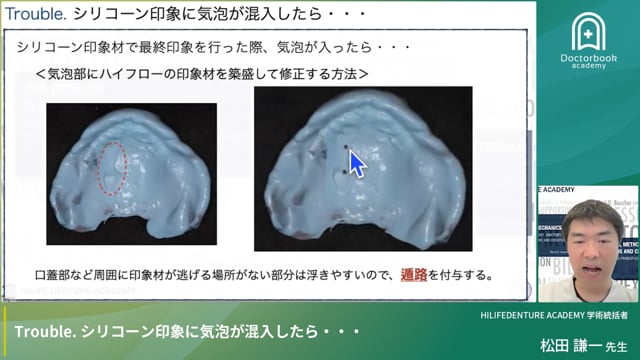 Trouble. シリコーン印象に気泡が混入したら・・・