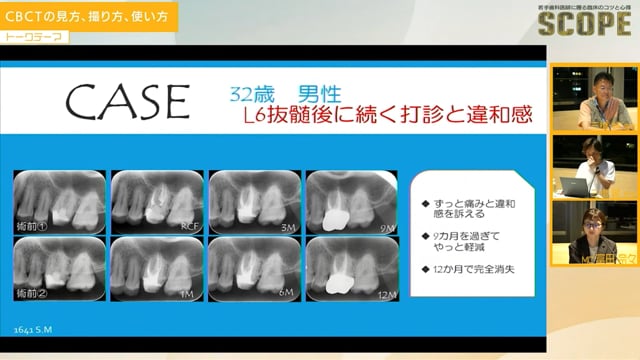 CBCTの見方、撮り方、使い方