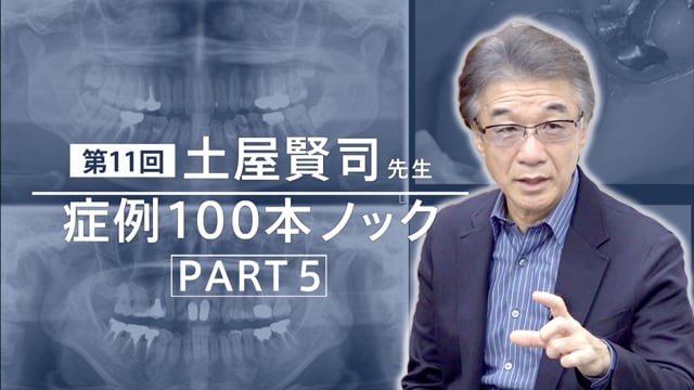 土屋賢司先生 症例100本ノック 第11回 PART5【期間限定プレミアム公開】