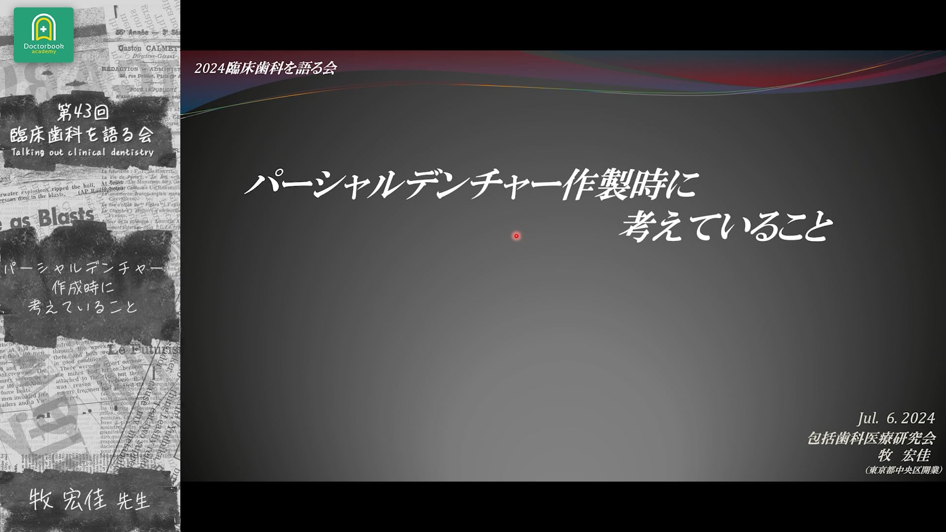 パーシャルデンチャー作成時に考えていること 牧宏佳先生