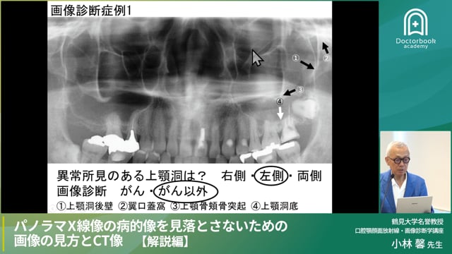 【解説編】診断力強化！各症例の解説で学ぶ正しい画像診断