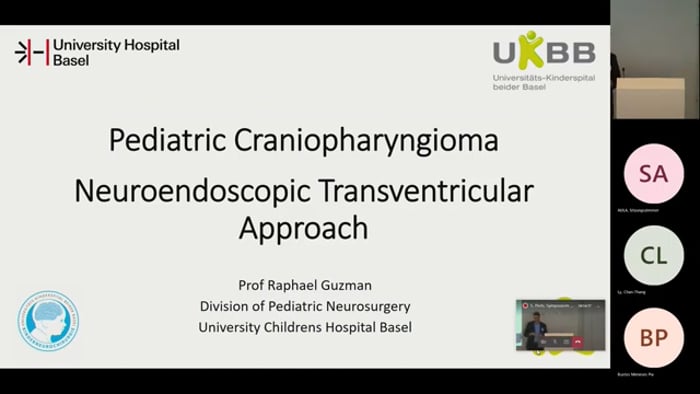 Pediatric Craniopharyngioma Pt.2, Neuroendoscopic Transventricular Approach