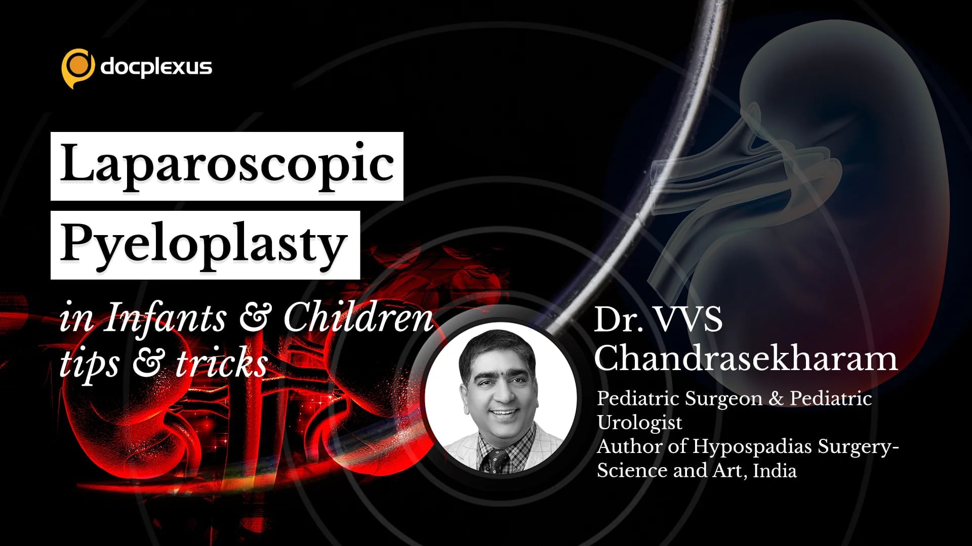 Laparoscopic Pyeloplasty in Infants and Children: Tips and Tricks