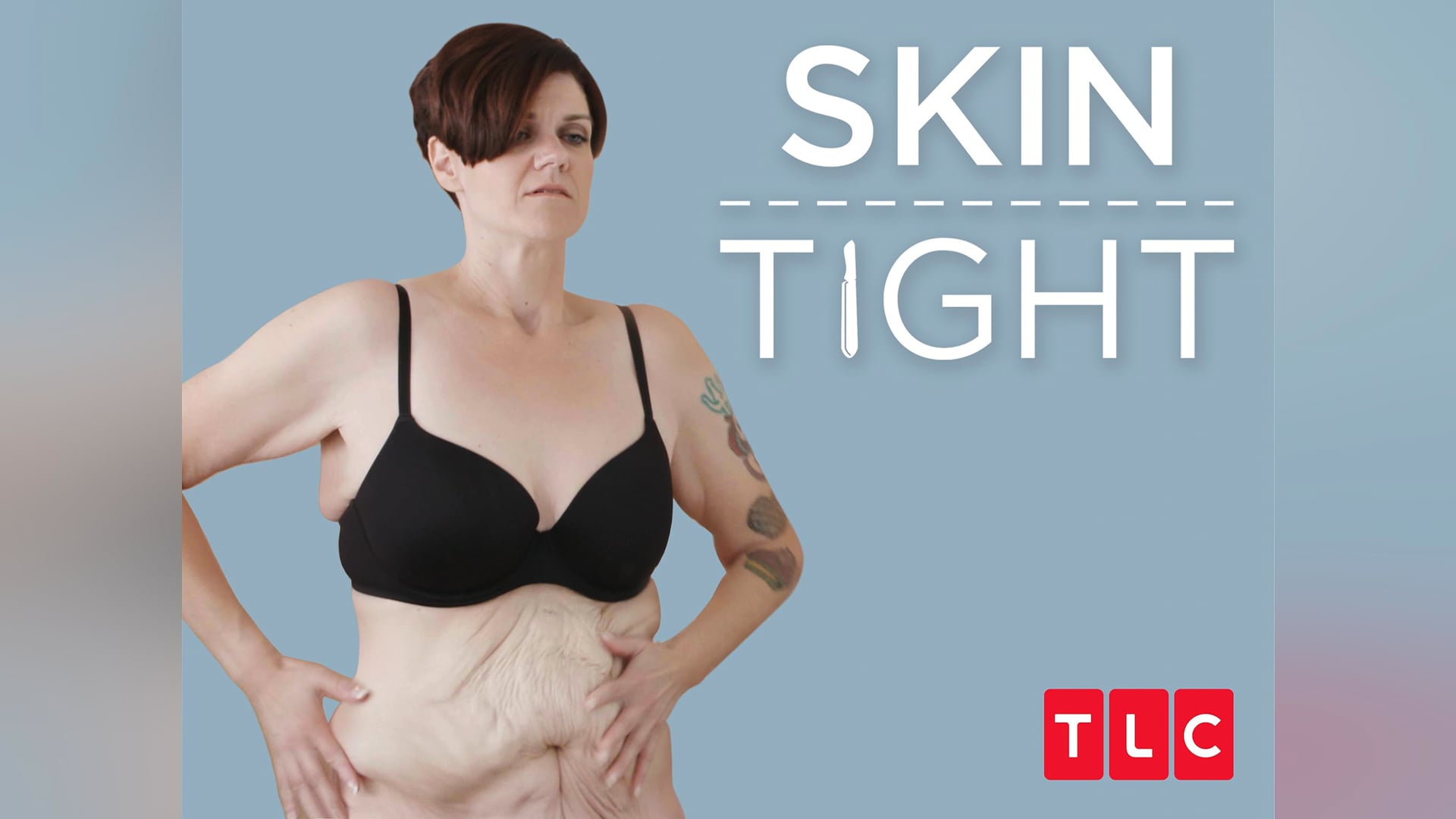 My 600lb Life: Skin Tight
