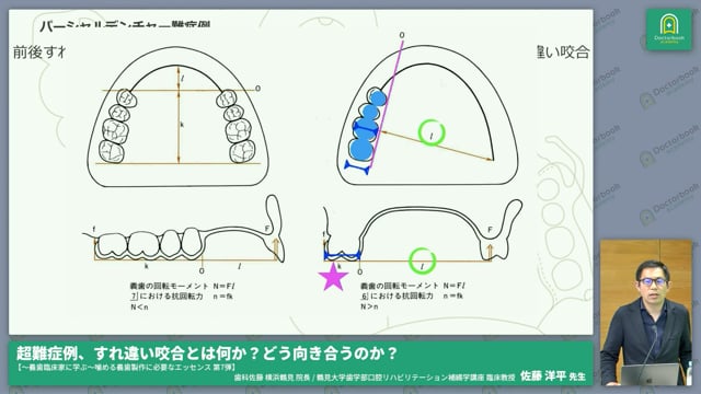 超難症例、すれ違い咬合とは何か？どう向き合うのか？