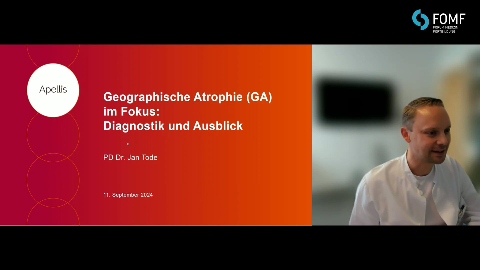 Geographische Atrophie (GA) im Fokus: Diagnostik und Ausblick 