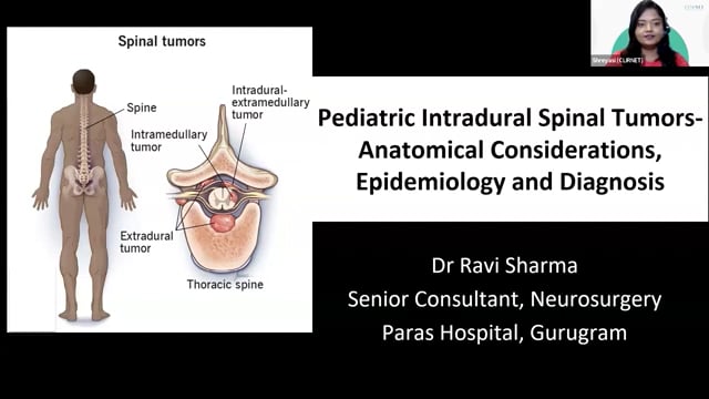 Pediatric Intradural Spinal Tumors – Anatomical Considerations, Epidemiology and Diagnosis