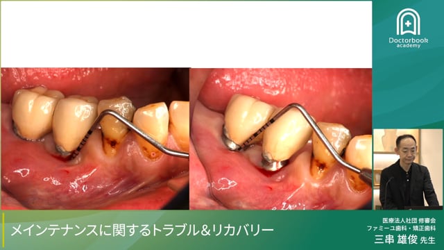 メンテナンスに関するトラブル&リカバリー							