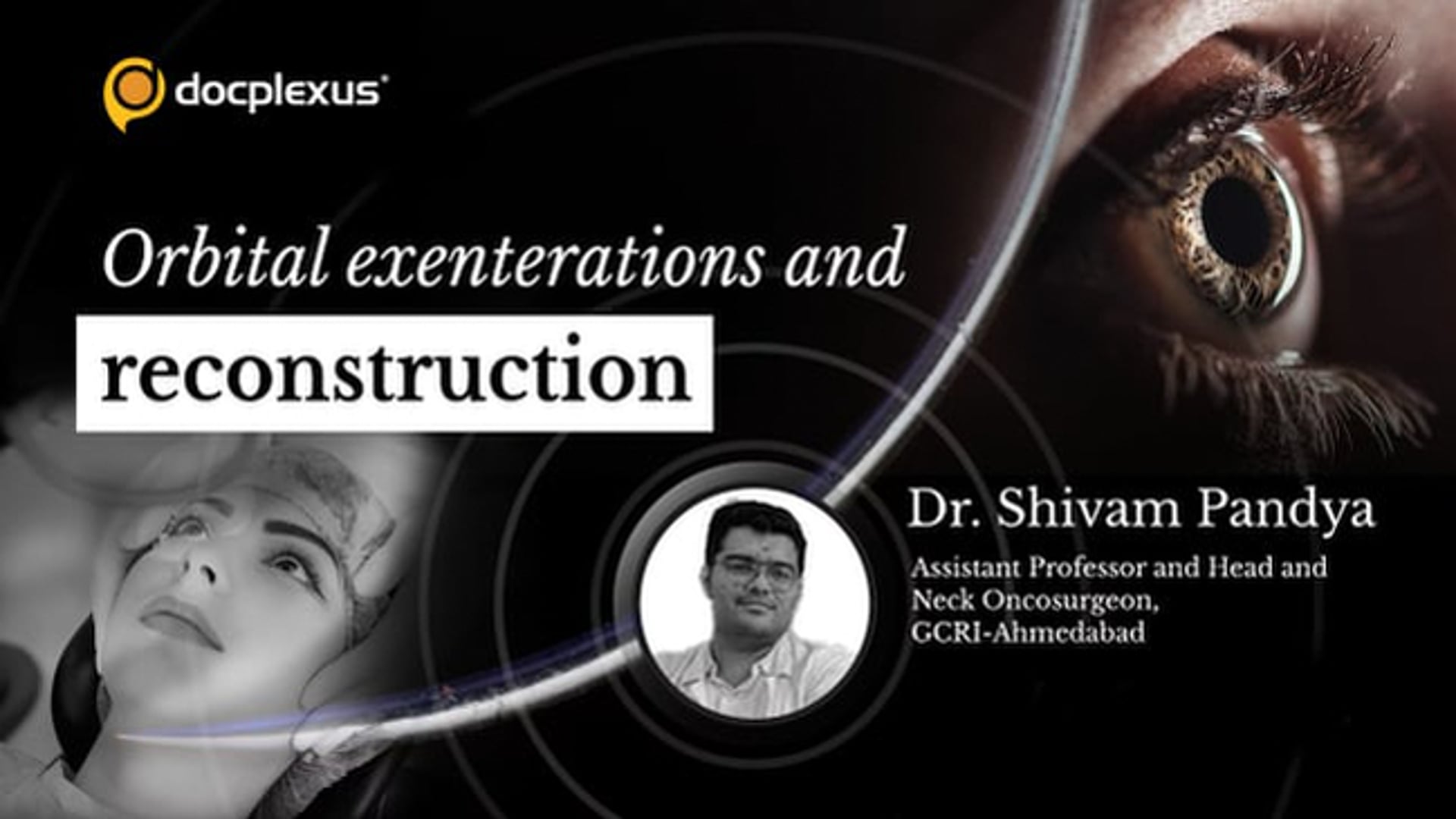 Orbital Exenterations and Reconstruction