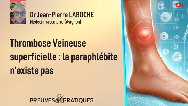 Thrombose Veineuse superficielle : la paraphlébite n’existe pas