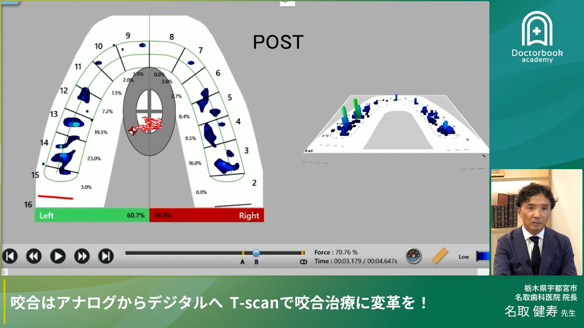 咬合はアナログからデジタルへ　T-scanで咬合治療に変革を！