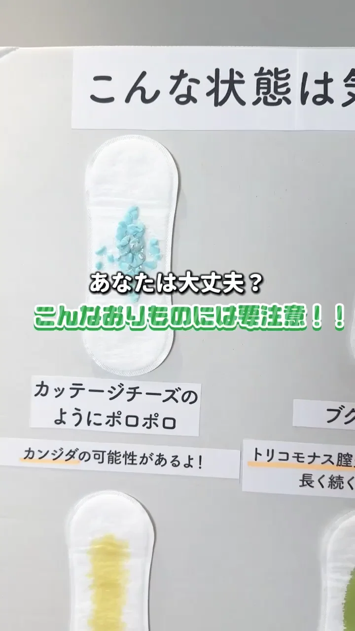 カッテージ チーズ 状 の おり もの