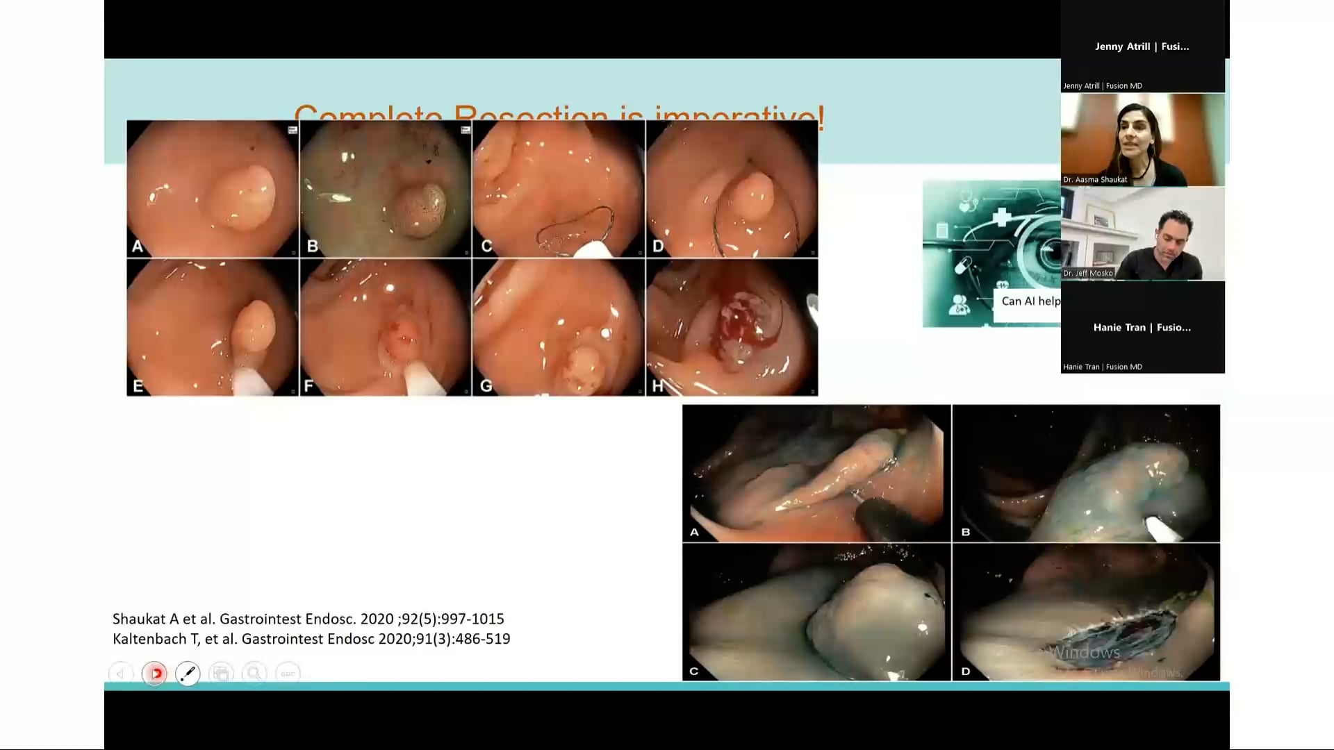 Artificial Intelligence to Help Polyp Detection (June 4, 2024)