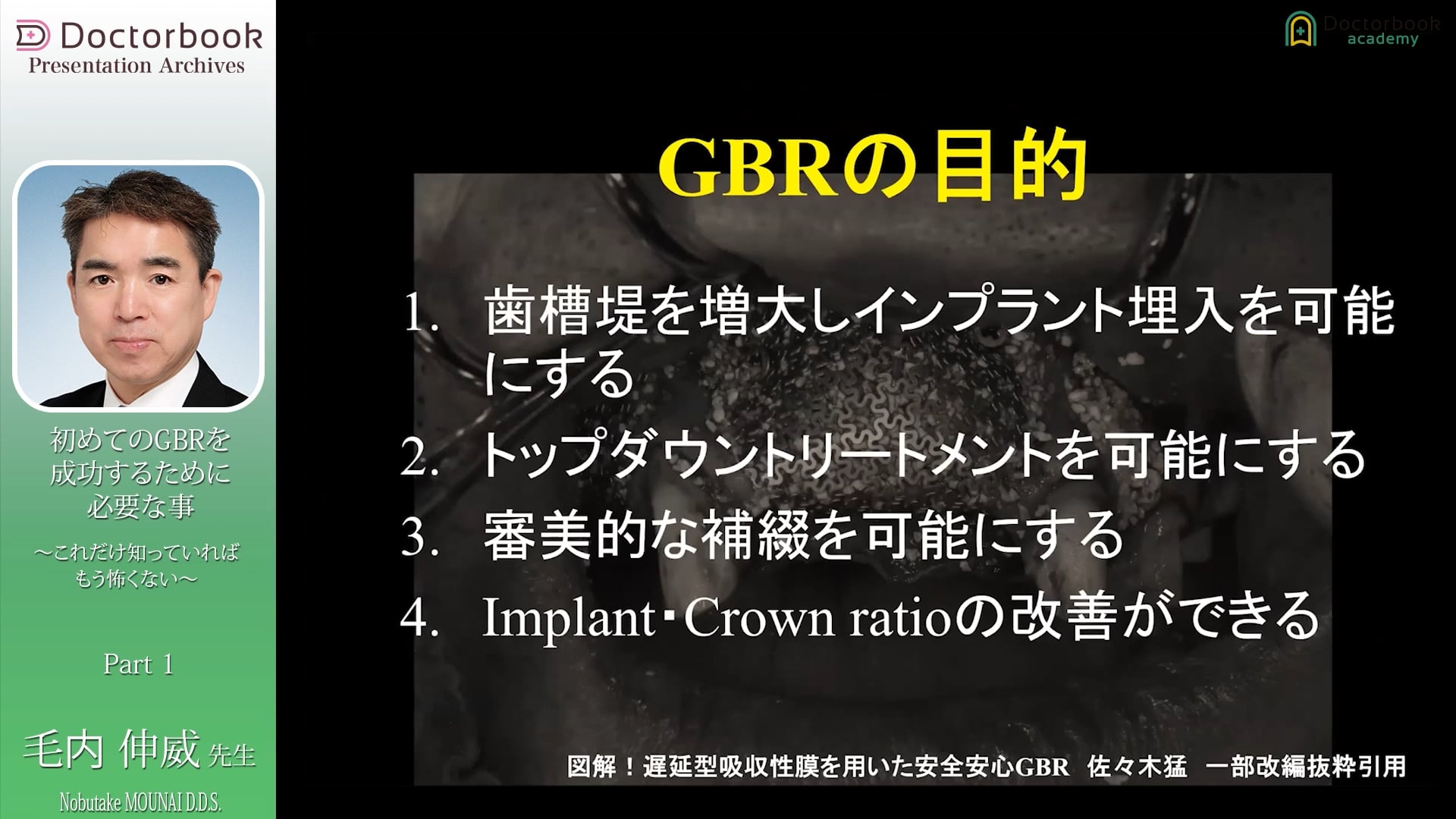  臨床知見録_GBR_GBRの目的