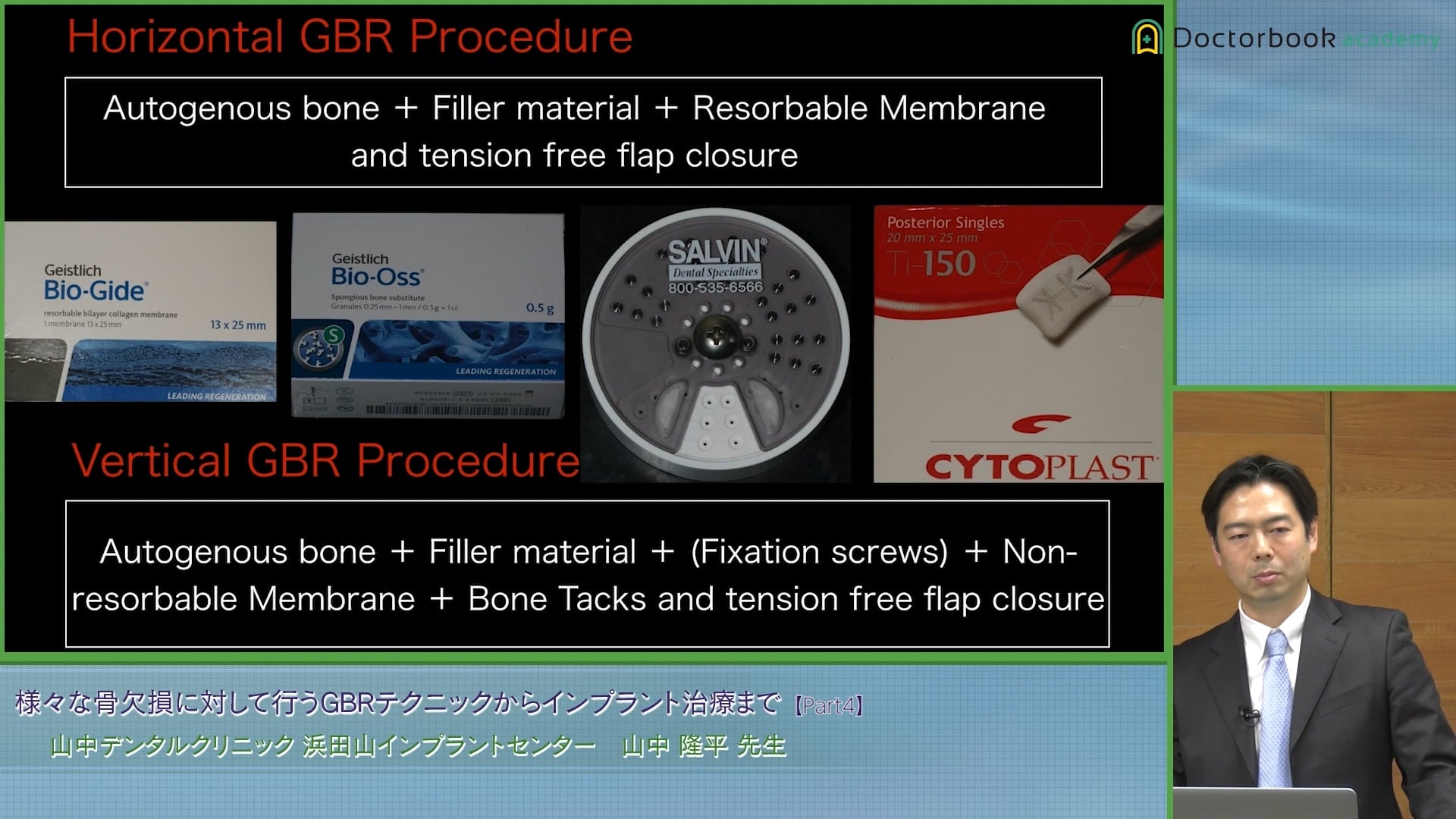  臨床知見録_GBR_水平的GBRと垂直的GBR