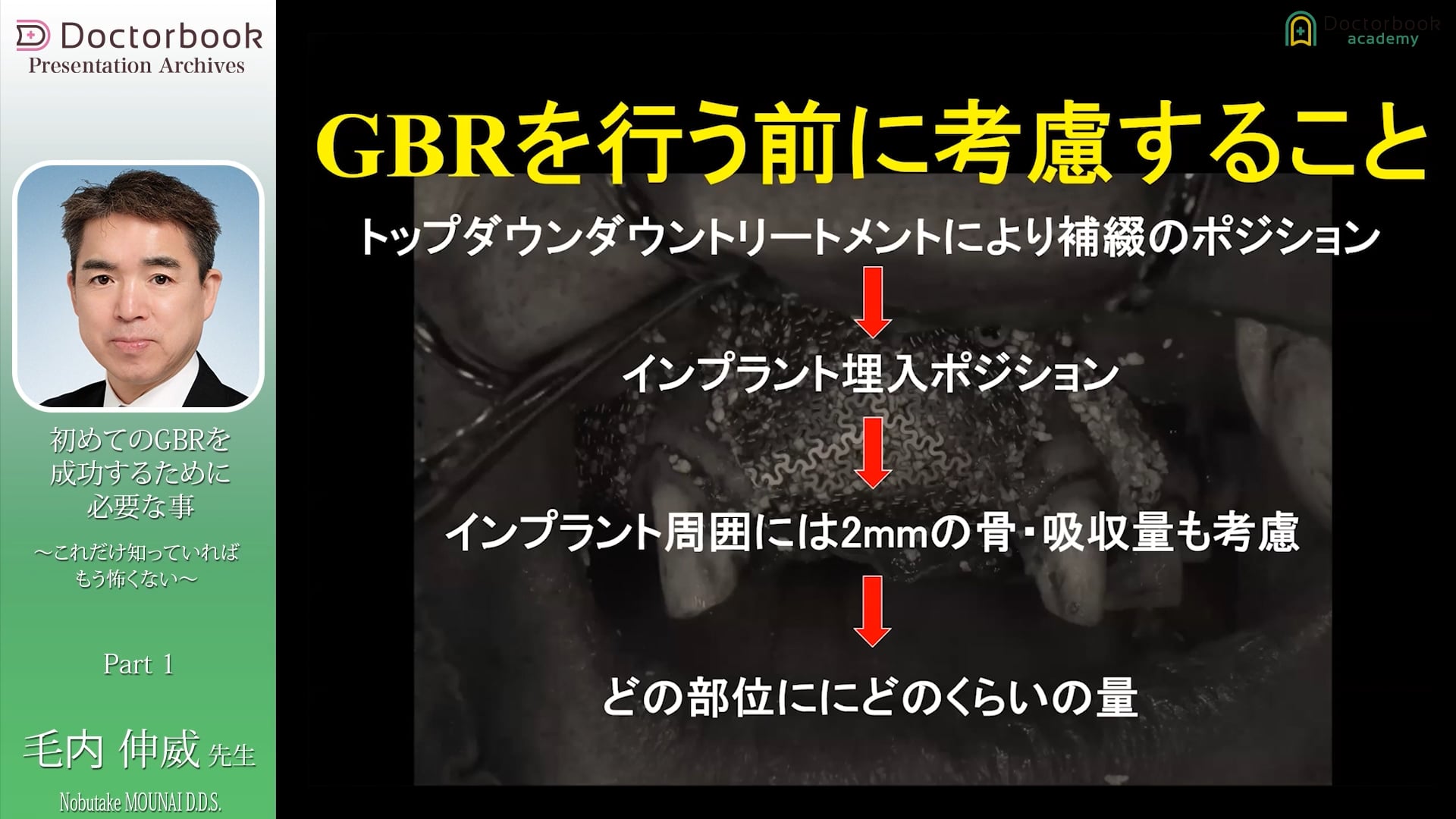  臨床知見録_GBR_考慮すべき点