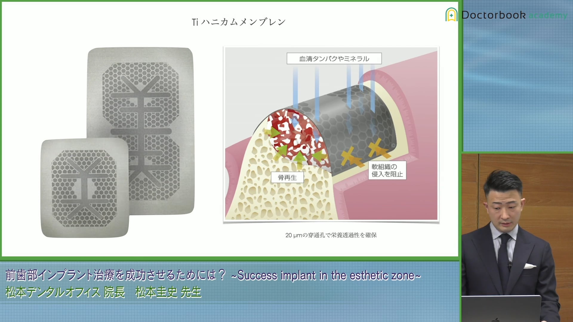  臨床知見録_GBR_モリタのハニカムメンブレン