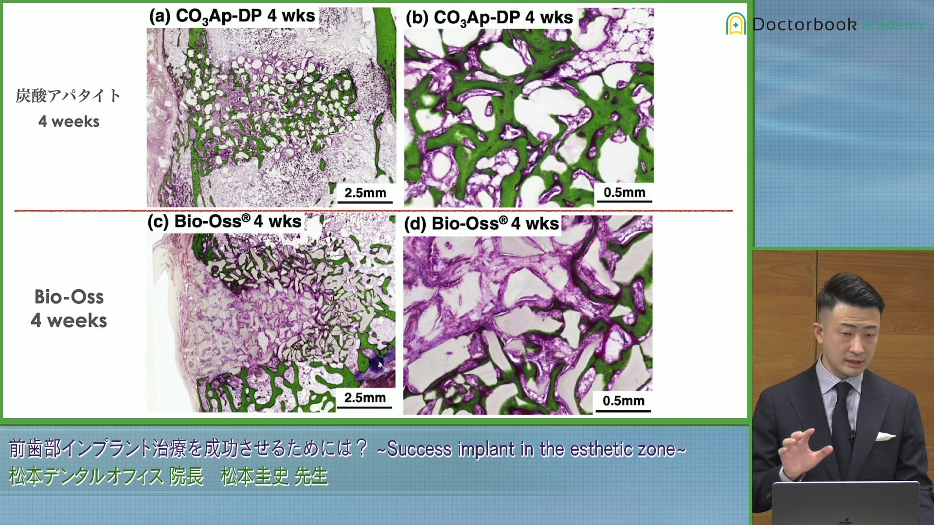  臨床知見録_GBR_サイトランスフラニュールとバイオスの比較