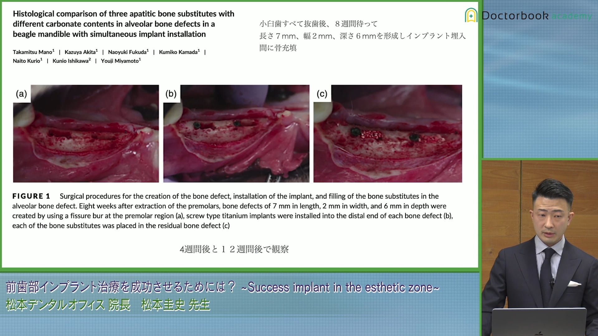  臨床知見録_GBR_サイトランス、バイオス、NEOBONEの比較