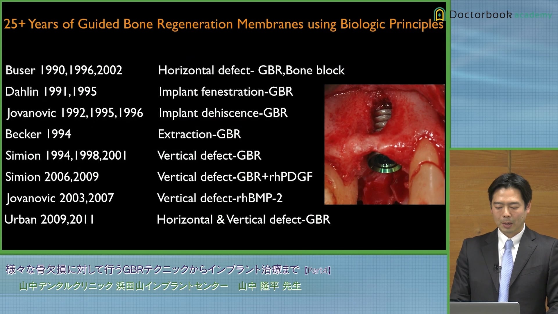  臨床知見録_GBR_GBRの歴史