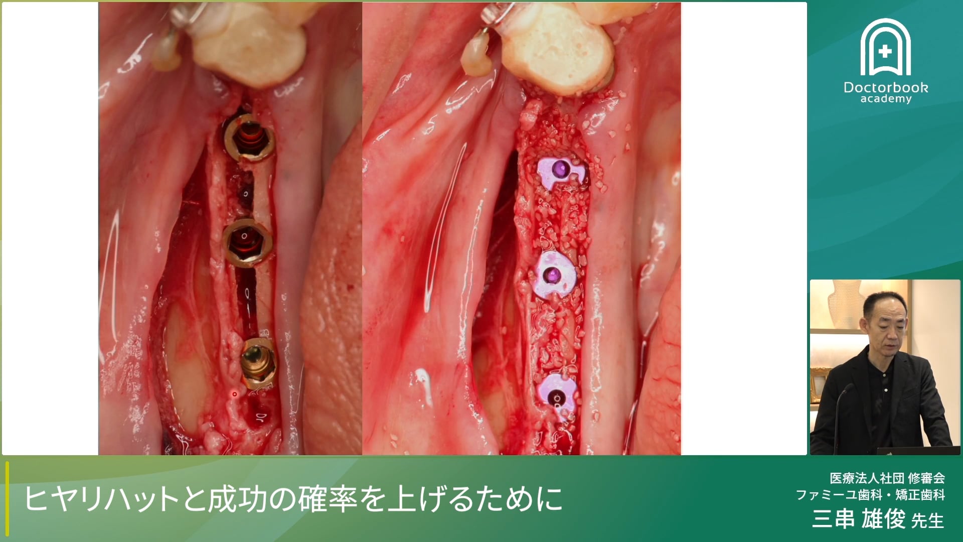 ヒヤリハットと成功の確率をあげるために