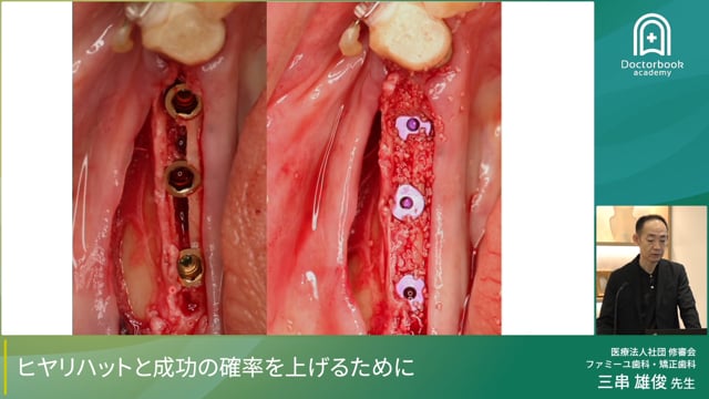 ヒヤリハットと成功の確率をあげるために