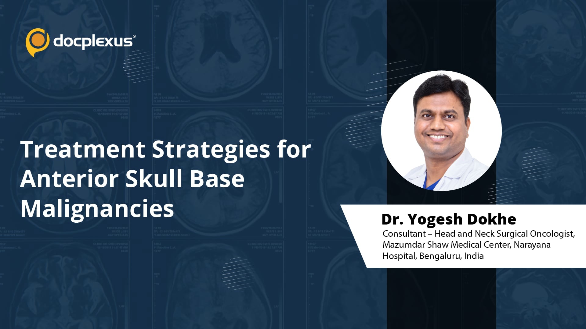 Treatment Strategies for Anterior Skull Base Malignancies